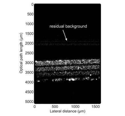 OCT cross-sectional image