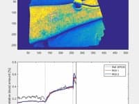 Example of microcirculatory blood perfusion and oxygenation with IMEC snapshot hyperspectral imaging camera