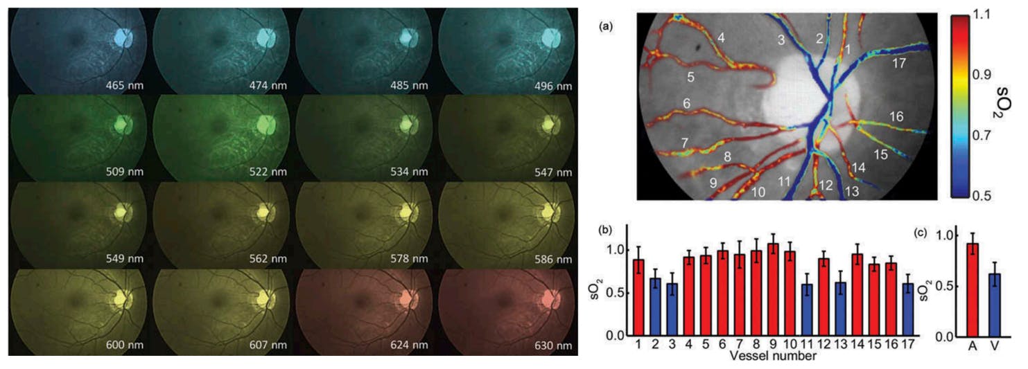 snapshot hyperspectral retina imaging oxygenation map